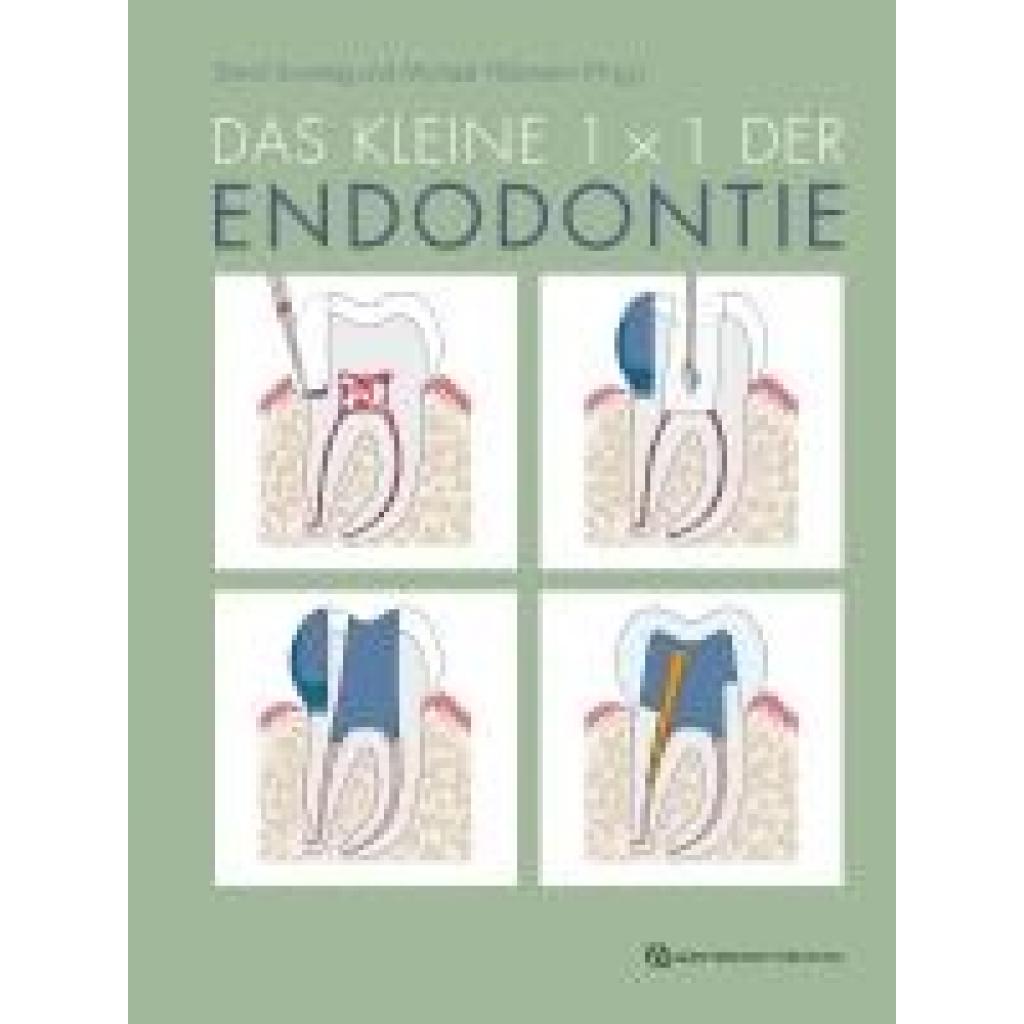 9783868676112 - Sonntag David Das kleine 1x1 der Endodontie