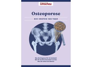 9783927216693 - Apotheken Umschau Osteoporose Kartoniert (TB)