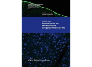 9783957580214 - Kovalente Protein- und RNA-Modifikationen bei hepatischer Enzephalopathie - Natalia Qvartskhava Kartoniert (TB)