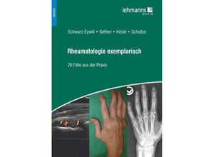 9783965430624 - Medizin   Rheumatologie exemplarisch - Michael Schwarz-Eywill Martin Gehlen Rosmarie Hösle Mareen Schultze Kartoniert (TB)