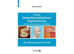 9783965434196 - Die besten Akupunkturindikationen Kopfschmerzen und weitere Erkrankungen der Kopfregion - Michael Rupprecht Kartoniert (TB)