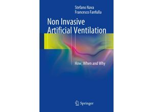 9788847055254 - Non Invasive Artificial Ventilation - Stefano Nava Francesco Fanfulla Kartoniert (TB)