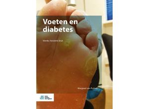 9789036802789 - Voeten en diabetes - M van Putten Kartoniert (TB)