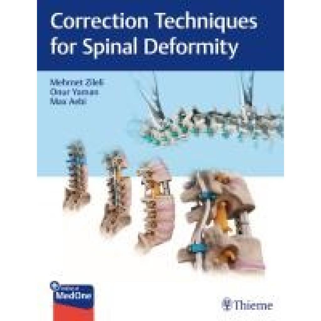 9789395390101 - Correction Techniques for Spinal Deformity