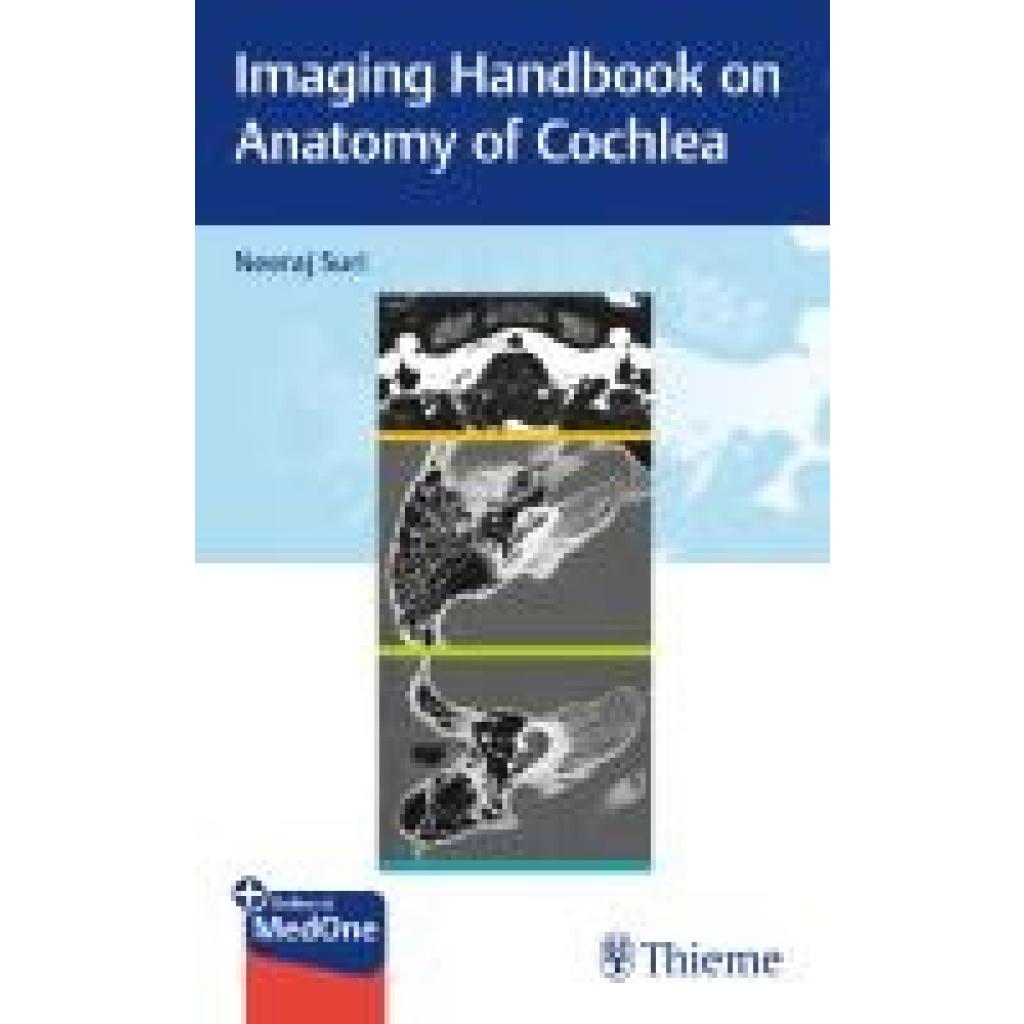 9789395390842 - Suri Neeraj Imaging Handbook on Anatomy of Cochlea